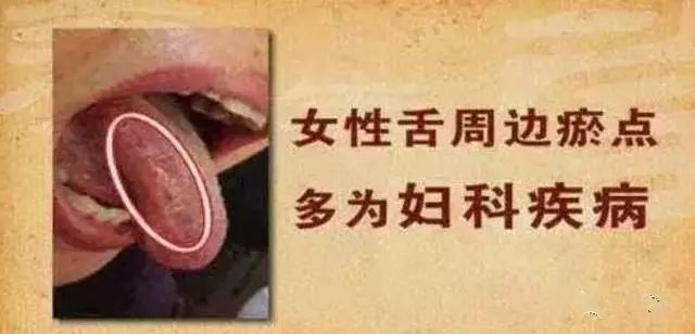 舌头，一旦出现这个信号，马上去医院！