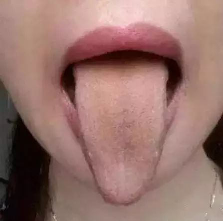 舌头，一旦出现这个信号，马上去医院！
