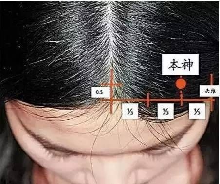 本神穴的准确穴位图及作用