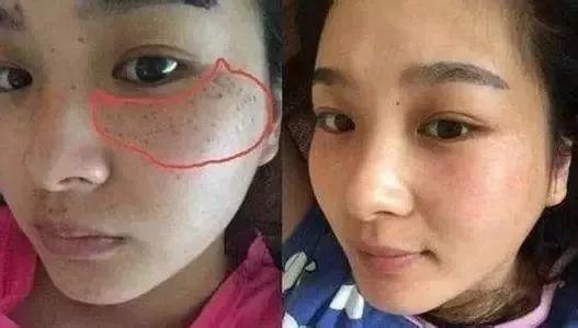 xue8-1543408103 xue8-1543408103