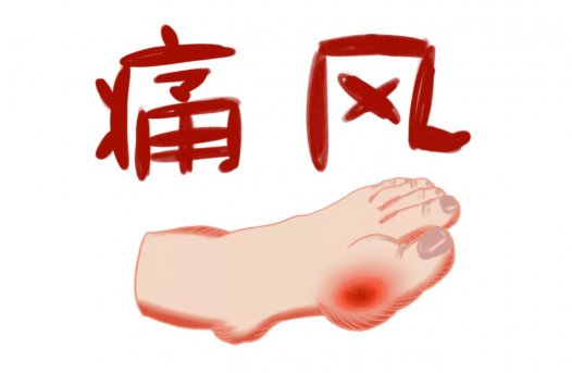 易医医派痛风酒带给痛风患者福音