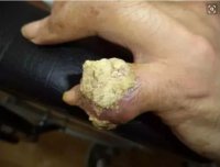 一种菜根是降尿酸的“高手”，每天泡水喝一点，治疗痛风很容易