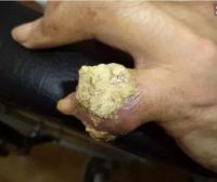 一种菜根是降尿酸的“高手”,每天泡水喝一点,治疗痛风很容易