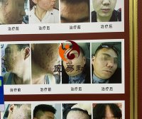 中医专病专治皮肤病