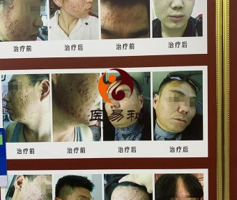 中医专病专治皮肤病