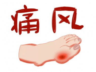 易医医派痛风酒带给痛风患者福音