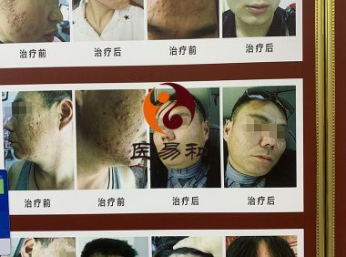 中医专病专治皮肤病