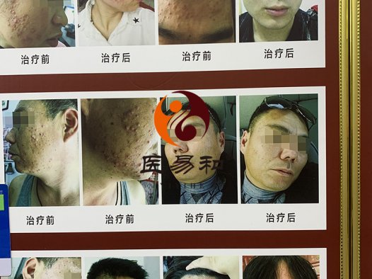 中医专病专治皮肤病